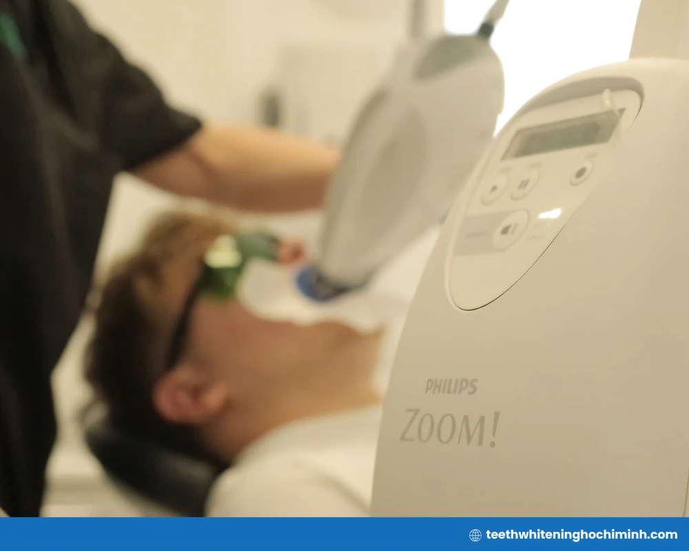 most recommended teeth whitening in ho chi minh city