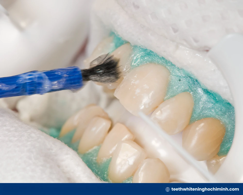 teeth whitening process at dentist
