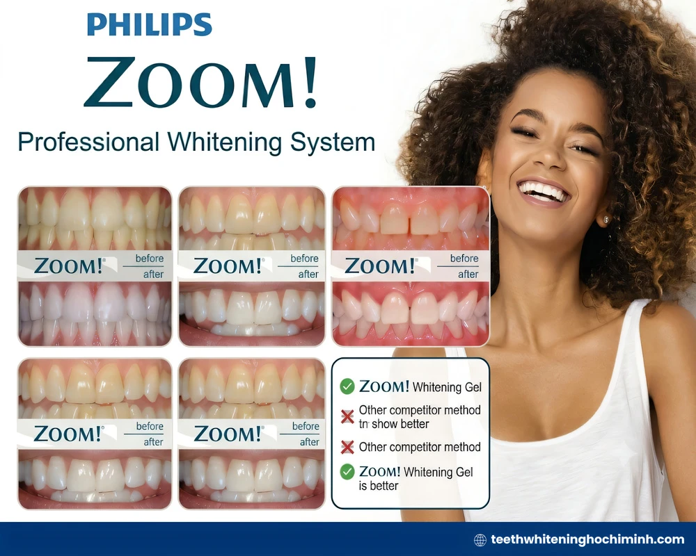 Philips zoom teeth whitening reviews: Is it the best in 2026?