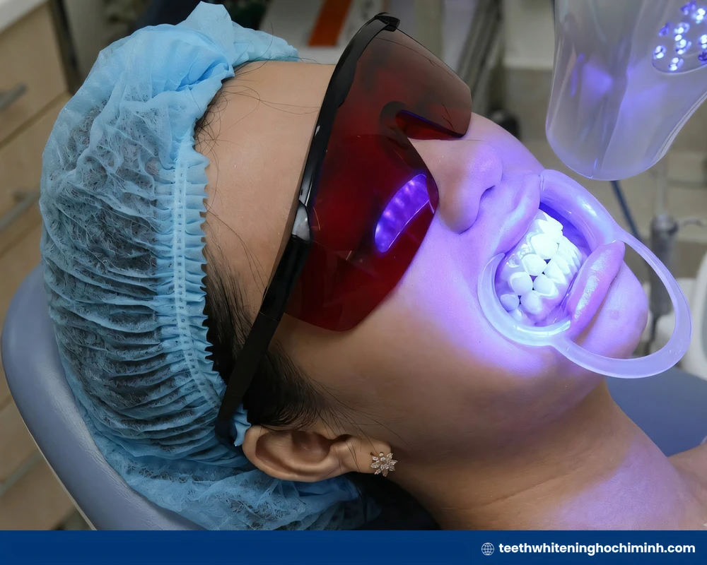 teeth whitening zoom