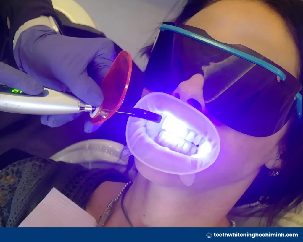 instant teeth whitening