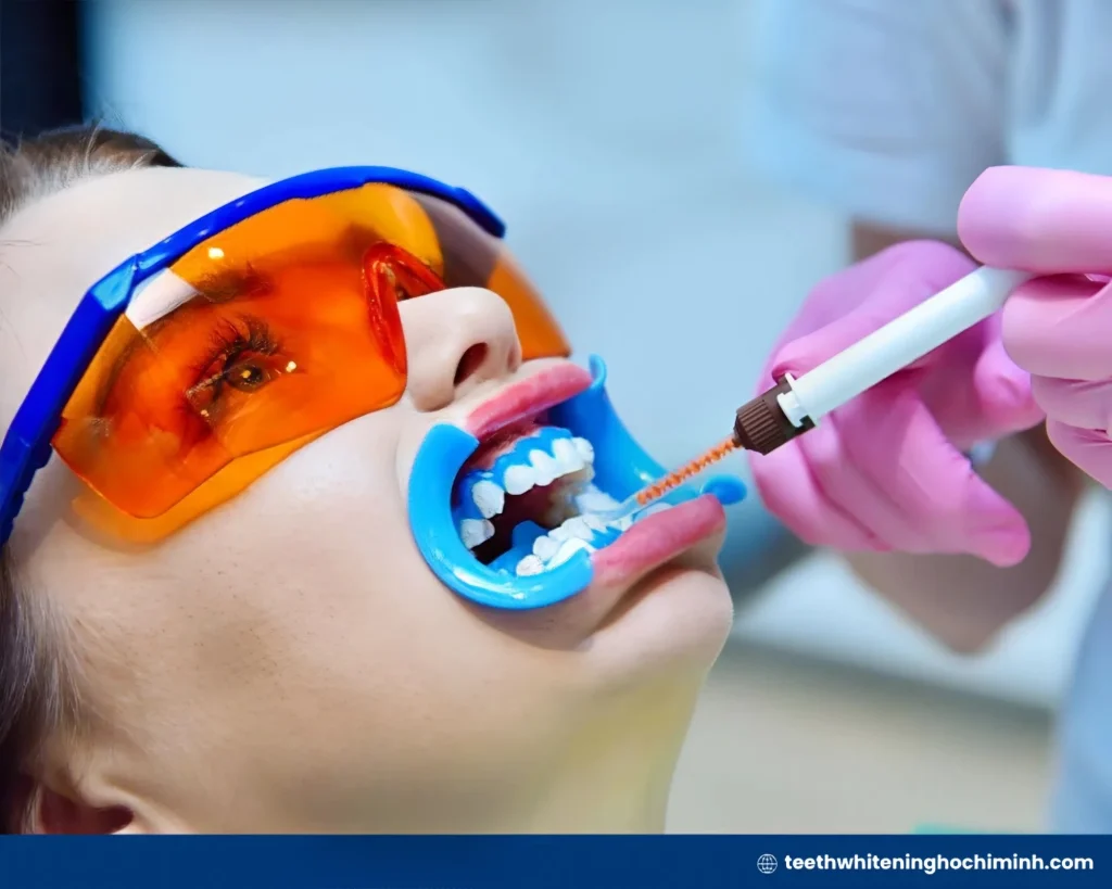 best safe teeth whitening