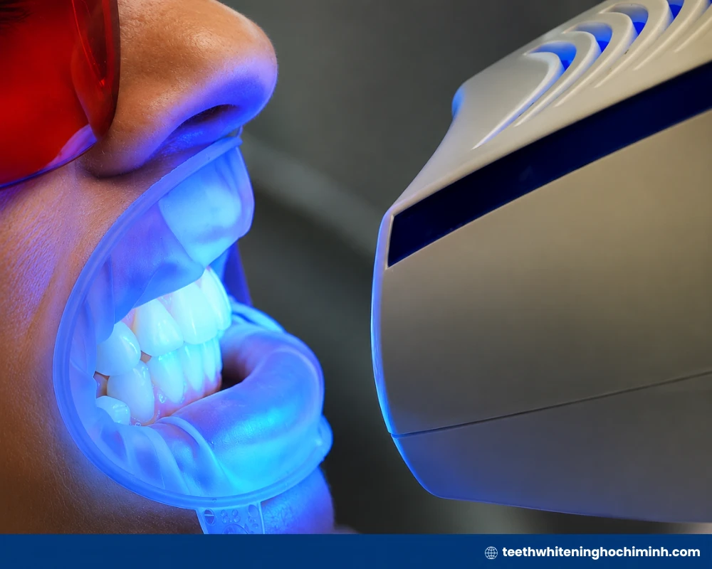 best professional teeth whitening procedure