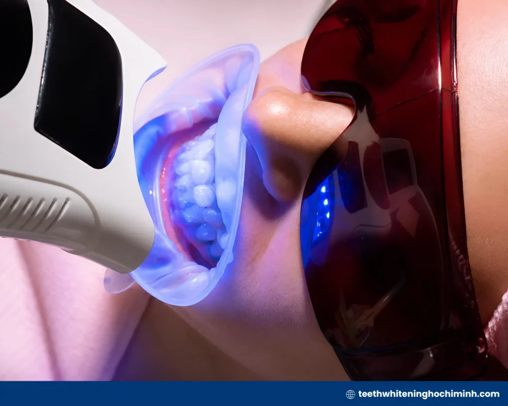best teeth whitening method