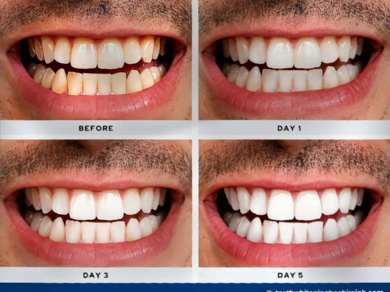 best teeth whitening method