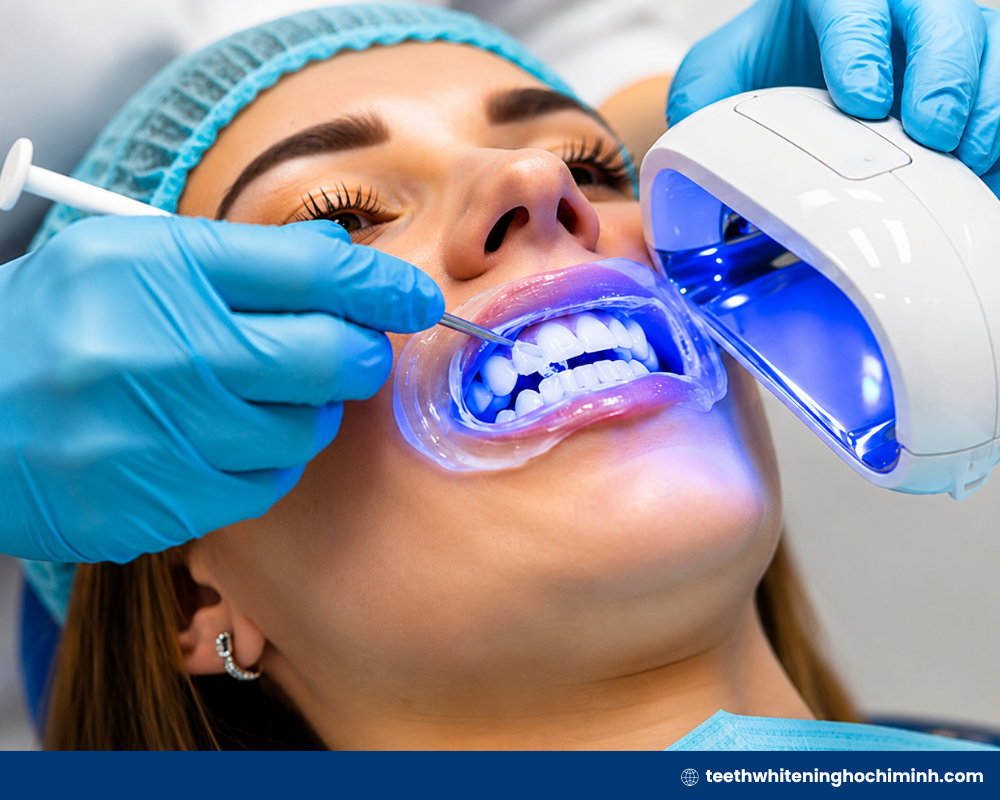 best teeth whitening kit