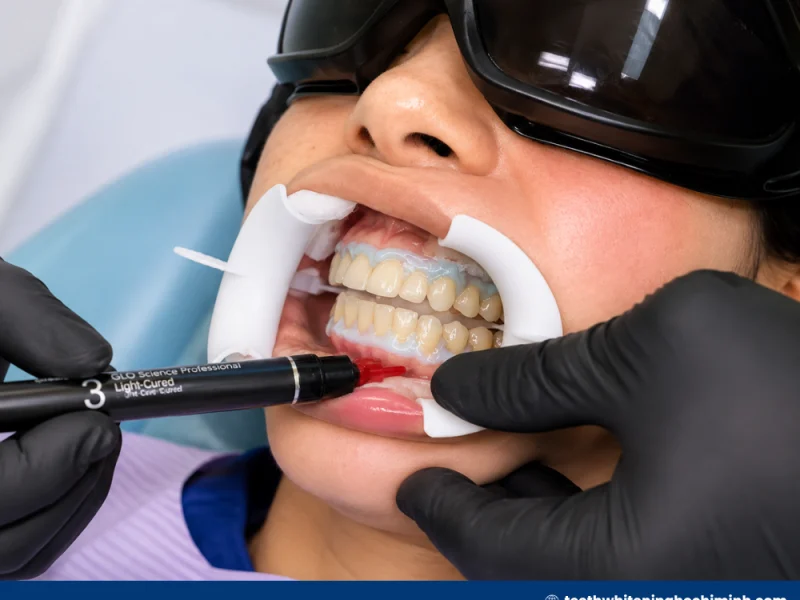 teeth whitening treatment