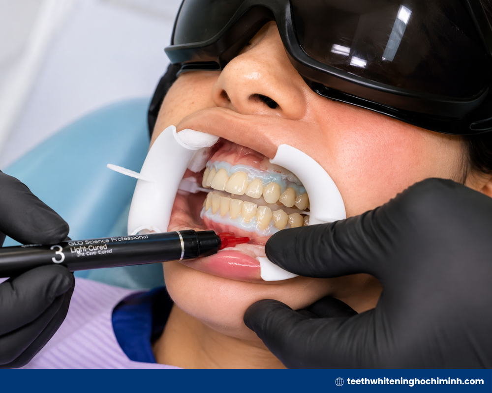 teeth whitening treatment