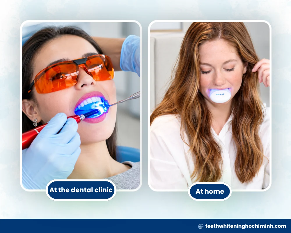 how long does teeth whitening take at dentist