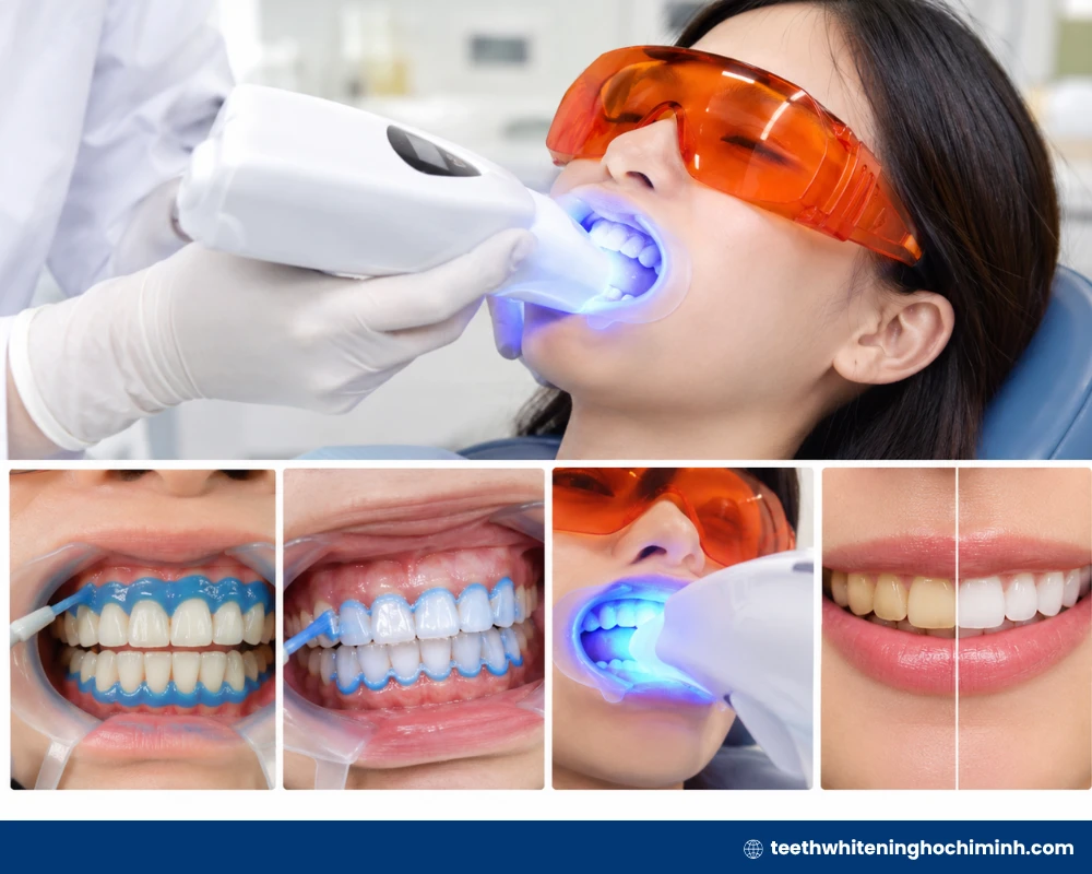 Snow teeth whitening how to use – Complete Guide for 2026 